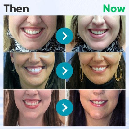 (🔥LAST DAY SALE-80% OFF) Taileden™ Gum Therapy Gel